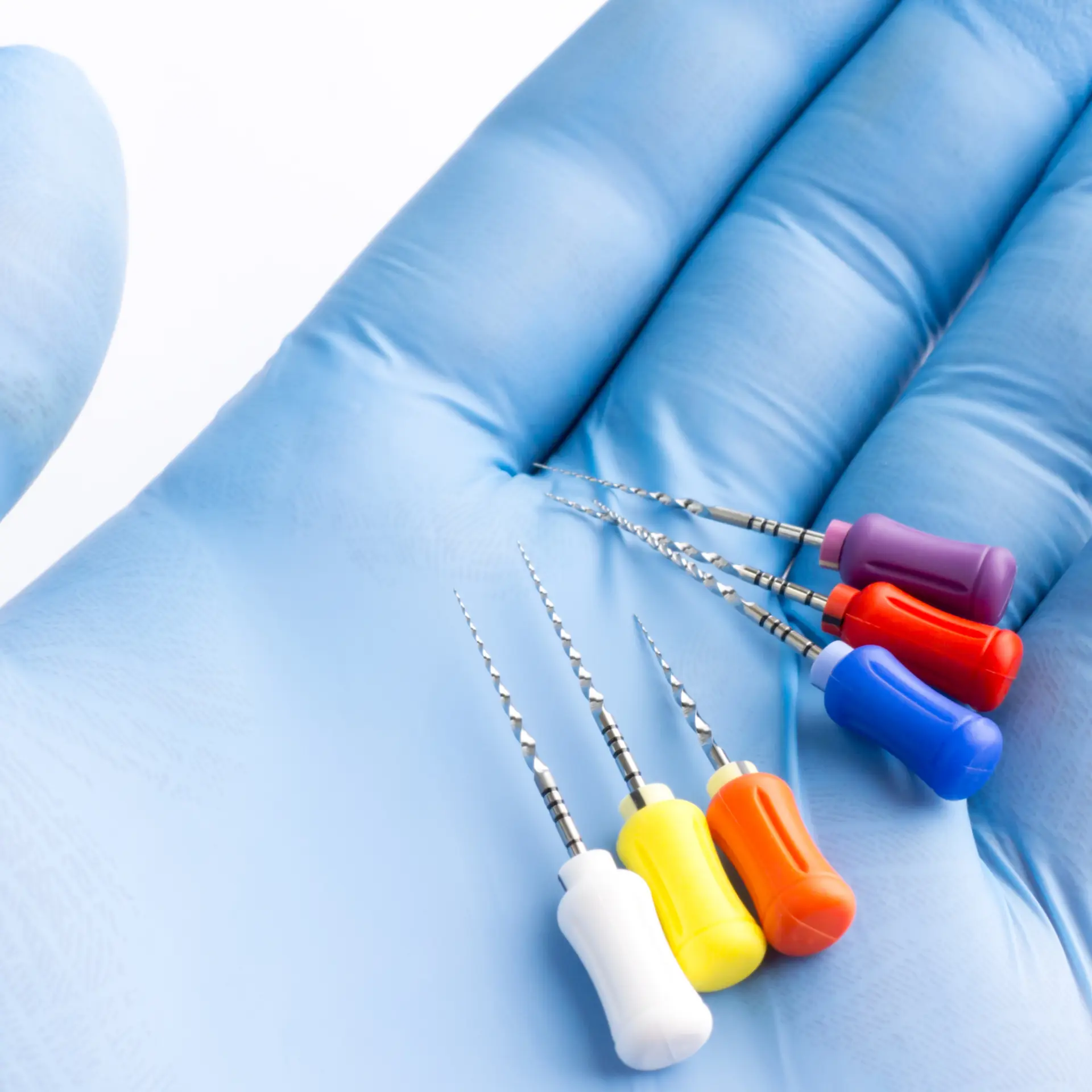 Endodonzia: quando devitalizzare un dente