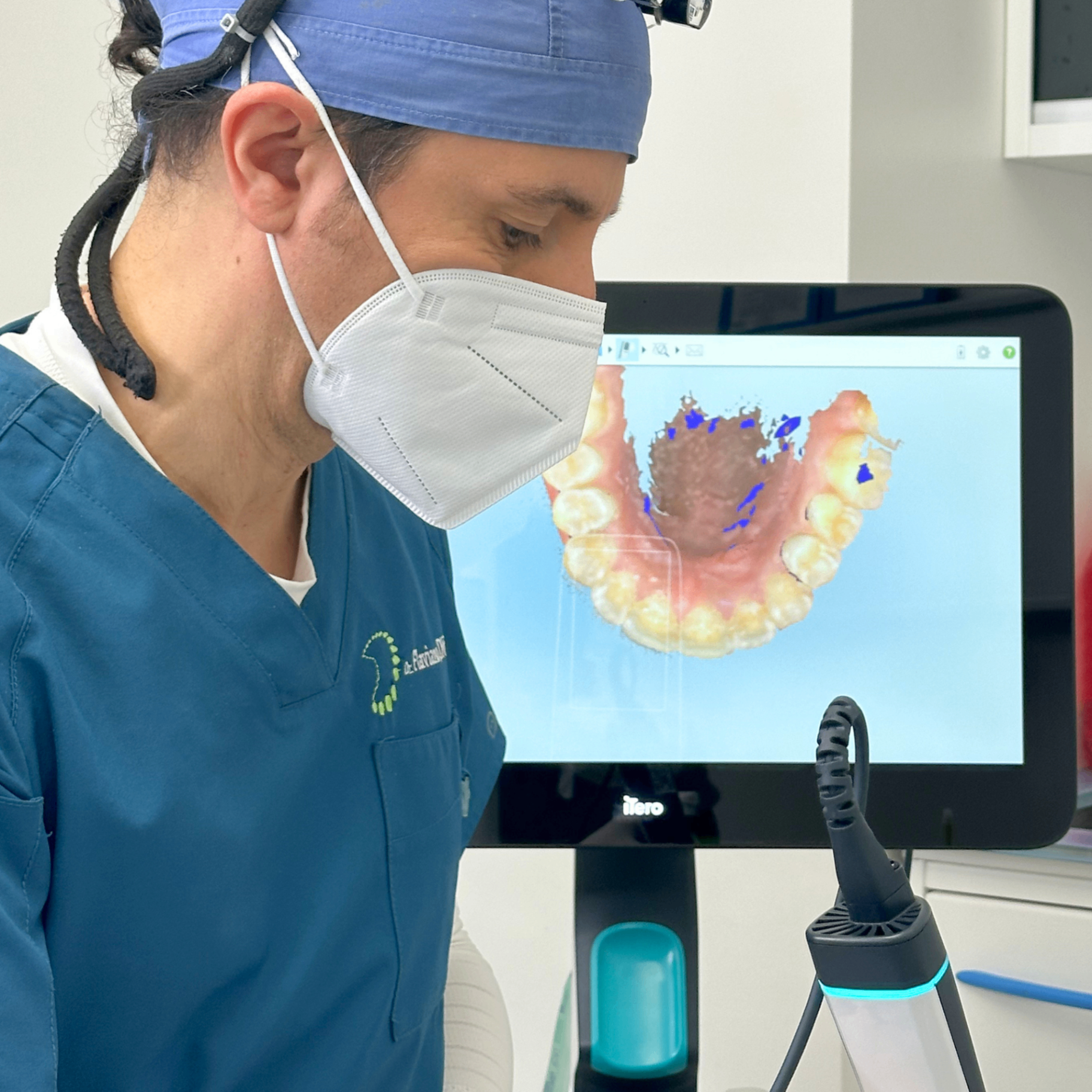 Diagnosi digitale con scanner intraorale iTero presso lo studio del Dott. Flaviano Di Vito