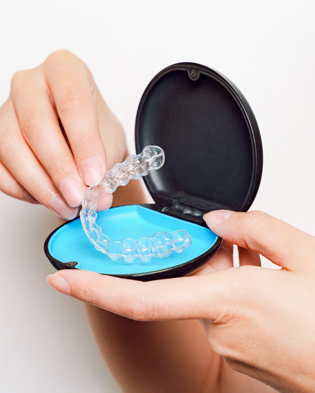 Mascherina trasparente Invisalign su modello dentale — Studio Di Vito